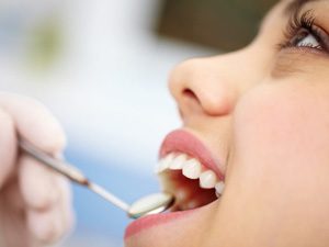 Коррекция уздечек зубов и языка