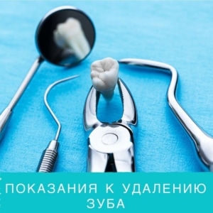 Показания к удалению зубов — «Премьера» на Петергофском ☎ +7 (812) 309-00-52 