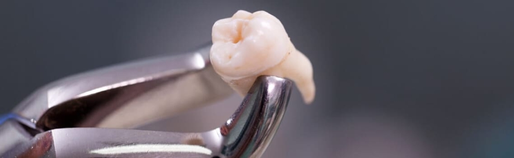 Безболезненное удаление зубов в СПб — стоматология «Премьера» ☎ +7 (812) 309-00-52