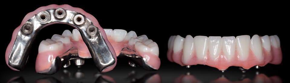 Несъемное протезирование зубов в СПб недорого — стоматология «Премьера» ☎ +7 (812) 309-00-52