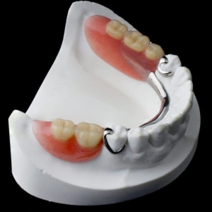 Частично съемные протезы зубов — стоматология «Премьера» ☎ +7 (812) 309-00-52
