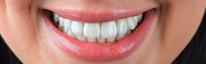 Протезы на передние зубы под ключ недорого в СПб — стоматология «Премьера» ☎ +7 (812) 309-00-52