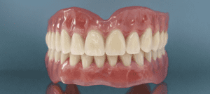 Акриловые протезы на передние зубы — стоматология «Премьера» ☎ +7 (812) 309-00-52