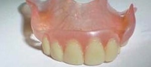 Зубные протезы Acry-free (АКРИ ФРИ) — стоматология «Премьера» ☎ +7 (812) 309-00-52