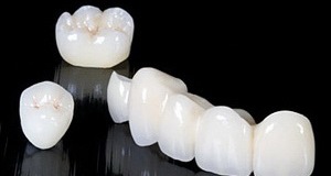 Коронки на жевательные зубы в СПб недорого — стоматология «Премьера» ☎ +7 (812) 309-00-52