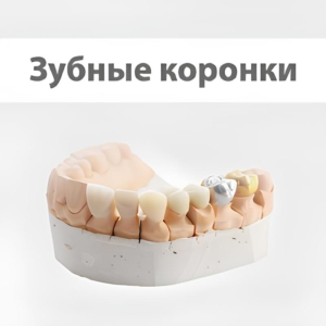 Зубные коронки в СПб под ключ — стоматология «Премьера» ☎ +7 (812) 309-00-52