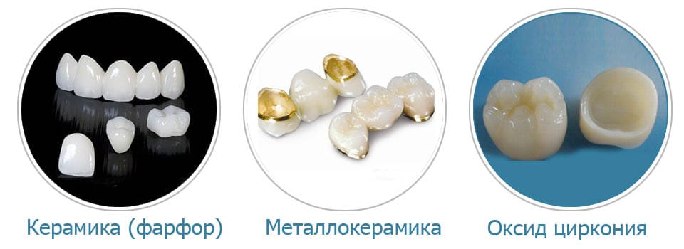 Коронки на зубы в СПб недорого — стоматология «Премьера» ☎ +7 (812) 309-00-52