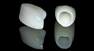 Керамические коронки на зубы в СПб — стоматология «Премьера» ☎ +7 (812) 309-00-52