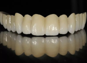 Зубные коронки на циркониевом каркасе — стоматология «Премьера» ☎ +7 (812) 309-00-52