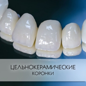 Безметалловые зубные коронки в СПб дешево — стоматология «Премьера» ☎ +7 (812) 309-00-52