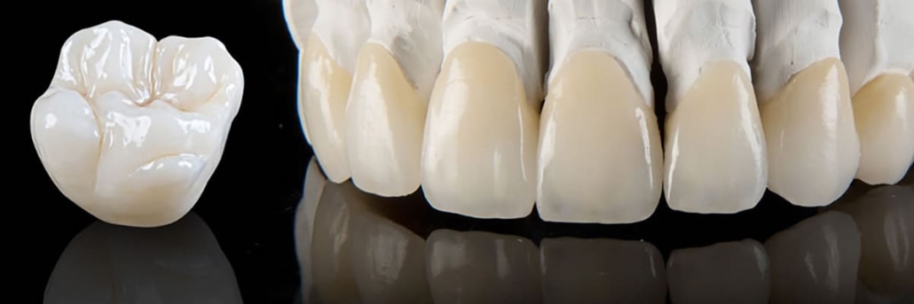 Безметалловая керамика на зубы — «Премьера» ☎ +7 (812) 309-00-52