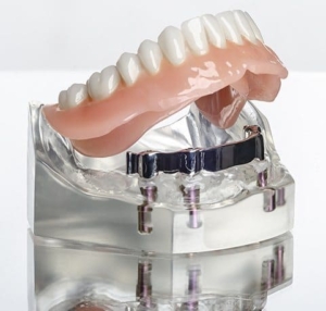 Полное протезирование зубов в СПб под ключ — «Премьера» ☎ +7 (812) 309-00-52