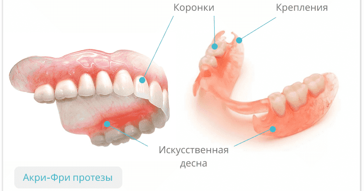Съемные зубные протезы Acry-Free (Акри Фри) под ключ в СПб — стоматология «Премьера» ☎ +7 (812) 309-00-52