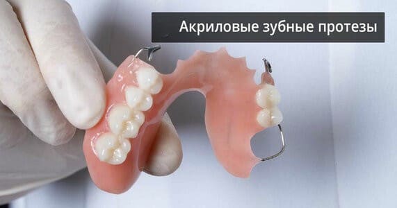 Зубные протезы из акрила под ключ в СПб — «Премьера» ☎ +7 (812) 309-00-52