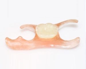 Нейлоновый протез-бабочка (иммедиат) — стоматология «Премьера» ☎ +7 (812) 309-00-52