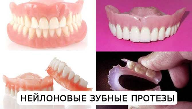 Зубные протезы из нейлона в СПб недорого — «Премьера» ☎ +7 (812) 309-00-52
