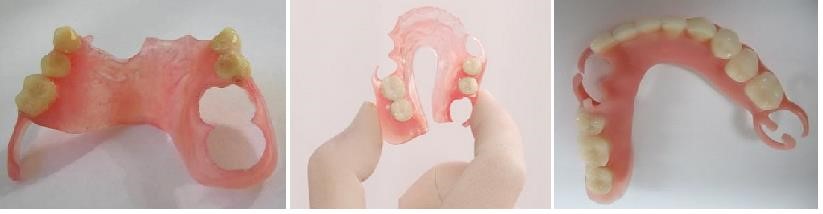 Мягкие съемные зубные протезы в СПб недорого — «Премьера» ☎ +7 (812) 309-00-52